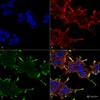 Immunocytochemistry/Immunofluorescence analysis using Mouse Anti-Alpha B Crystallin Monoclonal Antibody, Clone 1A7.D5 (STMA00035). Tissue: Neuroblastoma cell line (SK-N-BE). Species: Human. Fixation: 4% Formaldehyde for 15 min at RT. Primary Antibody: Mouse Anti-Alpha B Crystallin Monoclonal Antibody (STMA00035) at 1:100 for 60 min at RT. Secondary Antibody: Goat Anti-Mouse ATTO 488 at 1:100 for 60 min at RT.