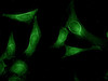 Immunocytochemistry/Immunofluorescence analysis using Rat Anti-Aha1 Monoclonal Antibody, Clone 25F2.D10 (STMA00045). Tissue: Cervical cancer cell line (HeLa). Species: Human. Primary Antibody: Rat Anti-Aha1 Monoclonal Antibody (STMA00045) at 1:1000. Secondary Antibody: FITC Goat Anti-Rat (green).