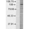 Western Blot analysis of Human Cervical cancer cell line (HeLa) lysate showing detection of HIF1 alpha protein using Mouse Anti-HIF1 alpha Monoclonal Antibody, Clone ESEE122 (STMA00049). Load: 15 µg. Block: 1.5% BSA for 30 minutes at RT. Primary Antibody: Mouse Anti-HIF1 alpha Monoclonal Antibody (STMA00049) at 1:500 for 2 hours at RT. Secondary Antibody: Sheep Anti-Mouse IgG: HRP for 1 hour at RT.