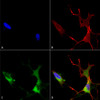 Immunocytochemistry/Immunofluorescence analysis using Mouse Anti-Cav1.2 Monoclonal Antibody, Clone S57 (STMA00080). Tissue: Neuroblastoma cells (SH-SY5Y). Species: Human. Fixation: 4% PFA for 15 min. Primary Antibody: Mouse Anti-Cav1.2 Monoclonal Antibody (STMA00080) at 1:50 for overnight at 4°C with slow rocking. Secondary Antibody: AlexaFluor 488 at 1:1000 for 1 hour at RT.