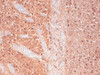 Immunohistochemistry analysis using Mouse Anti-CaV3.2 Calcium channel Monoclonal Antibody, Clone N55/10 (STMA00082). Tissue: frozen brain section. Species: Human. Fixation: 10% Formalin Solution for 12-24 hours at RT. Primary Antibody: Mouse Anti-CaV3.2 Calcium channel Monoclonal Antibody (STMA00082) at 1:1000 for 1 hour at RT.