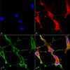 Immunocytochemistry/Immunofluorescence analysis using Mouse Anti-SHANK1 Monoclonal Antibody, Clone S22-21 (STMA00094). Tissue: Neuroblastoma cells (SH-SY5Y). Species: Human. Fixation: 4% PFA for 15 min. Primary Antibody: Mouse Anti-SHANK1 Monoclonal Antibody (STMA00094) at 1:50 for overnight at 4°C with slow rocking. Secondary Antibody: AlexaFluor 488 at 1:1000 for 1 hour at RT.