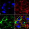 Immunocytochemistry/Immunofluorescence analysis using Mouse Anti-Nav1.8 Monoclonal Antibody, Clone S134 (STMA00100). Tissue: Neuroblastoma cells (SH-SY5Y). Species: Human. Fixation: 4% PFA for 15 min. Primary Antibody: Mouse Anti-Nav1.8 Monoclonal Antibody (STMA00100) at 1:50 for overnight at 4°C with slow rocking. Secondary Antibody: AlexaFluor 488 at 1:1000 for 1 hour at RT.