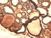Immunohistochemistry analysis using Mouse Anti-Sodium Iodide Symporter Monoclonal Antibody, Clone 14F (STMA00105). Tissue: Thyroid. Species: Mouse. Fixation: 10% Formalin Solution for 12-24 hours at RT. Primary Antibody: Mouse Anti-Sodium Iodide Symporter Monoclonal Antibody (STMA00105) at 1:1000 for 1 hour at RT.