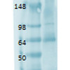 Western Blot analysis of Human thyroid lysate showing detection of Sodium Iodide Symporter protein using Mouse Anti-Sodium Iodide Symporter Monoclonal Antibody, Clone 14F (STMA00106). Primary Antibody: Mouse Anti-Sodium Iodide Symporter Monoclonal Antibody (STMA00106) at 1:1000.