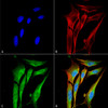 Immunocytochemistry/Immunofluorescence analysis using Mouse Anti-VAChT Monoclonal Antibody, Clone S6 (STMA00108). Tissue: Neuroblastoma cell line (SK-N-BE). Species: Human. Fixation: 4% Formaldehyde for 15 min at RT. Primary Antibody: Mouse Anti-VAChT Monoclonal Antibody (STMA00108) at 1:100 for 60 min at RT. Secondary Antibody: Goat Anti-Mouse ATTO 488 at 1:200 for 60 min at RT.