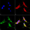 Immunocytochemistry/Immunofluorescence analysis using Mouse Anti-VGLUT2 Monoclonal Antibody, Clone N29/29 (STMA00110). Tissue: Neuroblastoma cells (SH-SY5Y). Species: Human. Fixation: 4% PFA for 15 min. Primary Antibody: Mouse Anti-VGLUT2 Monoclonal Antibody (STMA00110) at 1:50 for overnight at 4°C with slow rocking. Secondary Antibody: AlexaFluor 488 at 1:1000 for 1 hour at RT.