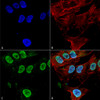 Immunocytochemistry/Immunofluorescence analysis using Mouse Anti-Cav3.1 Monoclonal Antibody, Clone N178A/9 (STMA00120). Tissue: Neuroblastoma cell line (SK-N-BE). Species: Human. Fixation: 4% Formaldehyde for 15 min at RT. Primary Antibody: Mouse Anti-Cav3.1 Monoclonal Antibody (STMA00120) at 1:100 for 60 min at RT. Secondary Antibody: Goat Anti-Mouse ATTO 488 at 1:200 for 60 min at RT.