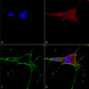 Immunocytochemistry/Immunofluorescence analysis using Mouse Anti-GluN1 Monoclonal Antibody, Clone N308/48 (STMA00124). Tissue: Neuroblastoma cells (SH-SY5Y). Species: Human. Fixation: 4% PFA for 15 min. Primary Antibody: Mouse Anti-GluN1 Monoclonal Antibody (STMA00124) at 1:50 for overnight at 4°C with slow rocking. Secondary Antibody: AlexaFluor 488 at 1:1000 for 1 hour at RT.