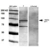 Western Blot analysis of Rat brain membrane lysate showing detection of GIT1 protein using Mouse Anti-GIT1 Monoclonal Antibody, Clone N39B/8 (STMA00125). Primary Antibody: Mouse Anti-GIT1 Monoclonal Antibody (STMA00125) at 1:1000.
