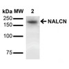 Western Blot analysis of Rat Brain showing detection of ~200 kDa NALCN protein using Mouse Anti-NALCN Monoclonal Antibody, Clone N187/7 (STMA00127). Lane 1: Molecular Weight (MW) Ladder. Lane 3: Rat Brain Membrane. Load: 15 µg. Block: 2% BSA and 2% Skim Milk in 1X TBST. Primary Antibody: Mouse Anti-NALCN Monoclonal Antibody (STMA00127) at 1:1000 for 16 hours at 4°C. Secondary Antibody: Goat Anti-Mouse IgG: HRP at 1:2000 for 60 min at RT.