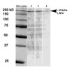 Western Blot analysis of Rat brain membrane lysate showing detection of LRP4 protein using Mouse Anti-LRP4 Monoclonal Antibody, Clone N207/27 (STMA00128). Primary Antibody: Mouse Anti-LRP4 Monoclonal Antibody (STMA00128) at 1:500, 1:1000, and 1:2000.
