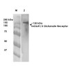 Western Blot analysis of Rat Brain Membrane showing detection of ~130 kDa mGluR5 protein using Mouse Anti-mGluR5 Monoclonal Antibody, Clone N75/3 (STMA00129). Lane 1: Molecular Weight (MW) Ladder. Lane 2: Rat Brain Membrane. Load: 10 µg. Block: 5% milk. Primary Antibody: Mouse Anti-mGluR5 Monoclonal Antibody (STMA00129) at 1:1000 for 1 hour at RT. Secondary Antibody: Goat Anti-Mouse IgG: HRP at 1:200 for 1 hour at RT.