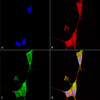 Immunocytochemistry/Immunofluorescence analysis using Mouse Anti-Brevican Monoclonal Antibody, Clone N294A/6 (STMA00133). Tissue: Neuroblastoma cells (SH-SY5Y). Species: Human. Fixation: 4% PFA for 15 min. Primary Antibody: Mouse Anti-Brevican Monoclonal Antibody (STMA00133) at 1:100 for overnight at 4°C with slow rocking. Secondary Antibody: AlexaFluor 488 at 1:1000 for 1 hour at RT.
