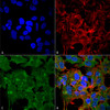 Immunocytochemistry/Immunofluorescence analysis using Mouse Anti-GluN2A Monoclonal Antibody, Clone N327A/38 (STMA00137). Tissue: Neuroblastoma cell line (SK-N-BE). Species: Human. Fixation: 4% Formaldehyde for 15 min at RT. Primary Antibody: Mouse Anti-GluN2A Monoclonal Antibody (STMA00137) at 1:100 for 60 min at RT. Secondary Antibody: Goat Anti-Mouse ATTO 488 at 1:200 for 60 min at RT.