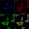 Immunocytochemistry/Immunofluorescence analysis using Mouse Anti-TASK1 Potassium Channel Monoclonal Antibody, Clone N374/48 (STMA00160). Tissue: Neuroblastoma cells (SH-SY5Y). Species: Human. Fixation: 4% PFA for 15 min. Primary Antibody: Mouse Anti-TASK1 Potassium Channel Monoclonal Antibody (STMA00160) at 1:50 for overnight at 4°C with slow rocking. Secondary Antibody: AlexaFluor 488 at 1:1000 for 1 hour at RT.