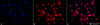 Immunocytochemistry/Immunofluorescence analysis using Rat Anti-HSF1 Monoclonal Antibody, Clone 4B4 (STMA00163). Tissue: Heat Shocked cervical cancer cells (HeLa). Species: Human. Fixation: 2% Formaldehyde for 20 min at RT. Primary Antibody: Rat Anti-HSF1 Monoclonal Antibody (STMA00163) at 1:100 for 12 hours at 4°C. Secondary Antibody: APC Goat Anti-Rat (red) at 1:200 for 2 hours at RT.