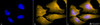 Immunocytochemistry/Immunofluorescence analysis using Rat Anti-HSF1 Monoclonal Antibody, Clone 10H4 (STMA00162). Tissue: Heat Shocked cervical cancer cells (HeLa). Species: Human. Fixation: 2% Formaldehyde for 20 min at RT. Primary Antibody: Rat Anti-HSF1 Monoclonal Antibody (STMA00162) at 1:100 for 12 hours at 4°C. Secondary Antibody: R-PE Goat Anti-Rat (yellow) at 1:200 for 2 hours at RT.