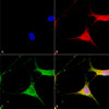 Immunocytochemistry/Immunofluorescence analysis using Mouse Anti-Kir6.1 Monoclonal Antibody, Clone N366/60 (STMA00170). Tissue: Neuroblastoma cells (SH-SY5Y). Species: Human. Fixation: 4% PFA for 15 min. Primary Antibody: Mouse Anti-Kir6.1 Monoclonal Antibody (STMA00170) at 1:100 for overnight at 4°C with slow rocking. Secondary Antibody: AlexaFluor 488 at 1:1000 for 1 hour at RT.