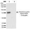 Western Blot analysis of Hexanoyl Lysine-BSA Conjugate showing detection of 67 kDa Hexanoyl-Lysine adduct protein using Mouse Anti-Hexanoyl-Lysine adduct Monoclonal Antibody, Clone 5D9 (STMA00179). Lane 1: Molecular Weight Ladder (MW). Lane 2: Hexanoyl Lysine-BSA. Lane 3: BSA. Load: 0.5 µg. Block: 5% Skim Milk in TBST. Primary Antibody: Mouse Anti-Hexanoyl-Lysine adduct Monoclonal Antibody (STMA00179) at 1:1000 for 2 hours at RT.