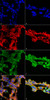 Immunocytochemistry/Immunofluorescence analysis using Mouse Anti-7-Ketocholesterol Monoclonal Antibody, Clone 7E1 (STMA00183). Tissue: Embryonic kidney epithelial cell line (HEK293). Species: Human. Fixation: 5% Formaldehyde for 5 min. Primary Antibody: Mouse Anti-7-Ketocholesterol Monoclonal Antibody (STMA00183) at 1:50 for 30-60 min at RT. Secondary Antibody: Goat Anti-Mouse Alexa Fluor 488 at 1:1500 for 30-60 min at RT.