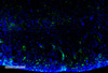 Immunohistochemistry analysis using Mouse Anti-Malondialdehyde Monoclonal Antibody, Clone 11E3 (STMA00185). Tissue: Kidney. Species: Mouse. Primary Antibody: Mouse Anti-Malondialdehyde Monoclonal Antibody (STMA00185) at 1:100 for Overnight at 4C, then 30 min at 37C. Secondary Antibody: Goat Anti-Mouse IgG (H+L): FITC for 45 min at 37C. Counterstain: DAPI for 3 min at RT. Magnification: 10X.