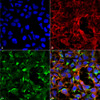 Immunocytochemistry/Immunofluorescence analysis using Mouse Anti-Dityrosine Monoclonal Antibody, Clone 7D4 (STMA00188). Tissue: Embryonic kidney cells (HEK293) cultured overnight with 50 µM H2O2. Species: Human. Fixation: 5% Formaldehyde for 5 min. Primary Antibody: Mouse Anti-Dityrosine Monoclonal Antibody (STMA00188) at 1:50 for 30-60 min at RT. Secondary Antibody: Goat Anti-Mouse Alexa Fluor 488 at 1:1500 for 30-60 min at RT.