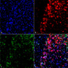 Immunocytochemistry/Immunofluorescence analysis using Mouse Anti-Alpha Synuclein Monoclonal Antibody, Clone 3F8 (STMA00193). Tissue: Primary hippocampal neurons treated with active Alpha Synuclein Protein Aggregate at 4 µg/ml to induce fibrils. Species: Rat. Fixation: 4% paraformaldehyde. Primary Antibody: Mouse Anti-Alpha Synuclein Monoclonal Antibody (STMA00193) at 1:200 for 24 hours at 4°C.