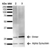 Western Blot analysis of Human Brain showing detection of 14 kDa Alpha Synuclein protein using Mouse Anti-Alpha Synuclein Monoclonal Antibody, Clone 3C11 (STMA00191). Lane 1: Molecular Weight Ladder (MW). Lane 2: Parkinson brain cell lystate. Lane 3: Human brain cell lysate. Load: 15 µg. Block: 5% Skim Milk in 1X TBST. Primary Antibody: Mouse Anti-Alpha Synuclein Monoclonal Antibody (STMA00191) at 1:1000 for 2 hours at RT.