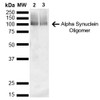 Western Blot analysis of Mouse, Rat Brain showing detection of 14 kDa Alpha Synuclein protein using Mouse Anti-Alpha Synuclein Monoclonal Antibody, Clone 3C11 (STMA00191). Lane 1: Molecular Weight Ladder (MW). Lane 2: Mouse brain cell lysate. Lane 3: Rat brain cell lysate. Load: 15 µg. Block: 5% Skim Milk in 1X TBST. Primary Antibody: Mouse Anti-Alpha Synuclein Monoclonal Antibody (STMA00191) at 1:1000 for 2 hours at RT.