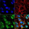 Immunocytochemistry/Immunofluorescence analysis using Mouse Anti-Alpha Synuclein Monoclonal Antibody, Clone 4F1 (STMA00194). Tissue: Neuroblastoma cell line (SK-N-BE). Species: Human. Fixation: 4% Formaldehyde for 15 min at RT. Primary Antibody: Mouse Anti-Alpha Synuclein Monoclonal Antibody (STMA00194) at 1:100 for 60 min at RT. Secondary Antibody: Goat Anti-Mouse ATTO 488 at 1:200 for 60 min at RT.