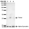 Western Blot analysis of Human, Mouse, Rat Brain showing detection of 14 kDa Alpha Synuclein protein using Mouse Anti-Alpha Synuclein Monoclonal Antibody, Clone 4F1 (STMA00194). Lane 1: Molecular Weight Ladder (MW). Lane 2: Mouse Brain cell lysate. Lane 3: Rat brain cell lysate. Lane 4: Human brain cell lysate. Load: 15 µg. Block: 5% Skim Milk in 1X TBST.