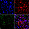 Immunocytochemistry/Immunofluorescence analysis using Mouse Anti-Alpha Synuclein Monoclonal Antibody, Clone 4F1 (STMA00194). Tissue: Primary hippocampal neurons treated with active Alpha Synuclein Protein Aggregate at 4 µg/ml to induce fibrils. Species: Rat. Fixation: 4% paraformaldehyde. Primary Antibody: Mouse Anti-Alpha Synuclein Monoclonal Antibody (STMA00194) at 1:200 for 24 hours at 4°C.