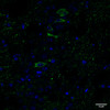 Immunohistochemistry analysis using Rabbit Anti-Tau Monoclonal Antibody, Clone AH36 (STMA00207). Tissue: Brain slice. Species: Mouse. Primary Antibody: Rabbit Anti-Tau Monoclonal Antibody (STMA00207) at 1:500 for Overnight at 4C. Secondary Antibody: Anti-Rabbit IgG: AlexaFluor 488. Counterstain: DAPI at 1:1000 for 5 min. CA3 Region of P301SxUBQLN2 Tg mouse. IHC Protocol: 1.
