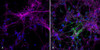 Immunocytochemistry/Immunofluorescence analysis using Rabbit Anti-Alpha Synuclein (pSer129) Monoclonal Antibody, Clone J18 (STMA00206). Tissue: iPSC-derived neurons. Species: Human. Primary Antibody: Rabbit Anti-Alpha Synuclein (pSer129) Monoclonal Antibody (STMA00206) at 1:1000 for O/N at 4°C. Secondary Antibody: Anti-Rabbit: A488 at 1:1000 for 1 hour at RT. Magnification: 40X. Nuclear stain: Hoechst- 20 min, RT (blue).