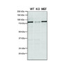 Western Blot analysis of Human, Mouse A549, MEF showing detection of VPS35 protein using Mouse Anti-VPS35 Monoclonal Antibody, Clone 5A9 (STMA00209). Lane 1: Molecular Weight Ladder. Lane 2: VPS35 KO A549 cells. Lane 3: mouse embryonic fibroblast cells. Load: 8 µg each A549 and MEF. Primary Antibody: Mouse Anti-VPS35 Monoclonal Antibody (STMA00209) at 1:5 (tissue culture supernatant).