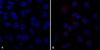 Immunocytochemistry/Immunofluorescence analysis using Mouse Anti-VPS35 Monoclonal Antibody, Clone 10A8 (STMA00211). Tissue: A549 cells. Species: Human. Primary Antibody: Mouse Anti-VPS35 Monoclonal Antibody (STMA00211) at 1:5 (tissue culture supernatant). Secondary Antibody: Donkey anti-mouse: Alexa Fluor 594 at 1:4000 in 0.2% BSA PBS. Counterstain: DAPI. Localization: Vesicles. A) VPS35 KO A549 cells B) WT A549 cells.