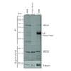 Immunoprecipitation analysis using Mouse Anti-VPS35 Monoclonal Antibody, Clone 10A8 (STMA00211). Tissue: A549 cells. Species: Human. Primary Antibody: Mouse Anti-VPS35 Monoclonal Antibody (STMA00211). 500 µL cell culture supernatants were incubated with 10 µL of Protein A/G resin beads for 1 hour at 4⁰C. STMA00211 clone 10A8 depletes VPS35 from the A549 cell extract.
