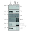 Immunoprecipitation analysis using Mouse Anti-VPS35 Monoclonal Antibody, Clone 10A8 (STMA00211). Tissue: A549 cells. Species: Human. Primary Antibody: Mouse Anti-VPS35 Monoclonal Antibody (STMA00211).