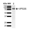 Mouse Anti-VPS35 Antibody [10A8] used in Western Blot (WB) on Human SH-SY5Y (STMA00211)