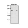 Western Blot analysis of Human, Mouse A549, MEF showing detection of VPS35 protein using Mouse Anti-VPS35 Monoclonal Antibody, Clone 11H10 (STMA00212). Lane 1: Molecular Weight Ladder. Lane 2: VPS35 KO A549 cells. Lane 3: mouse embryonic fibroblast cells. Load: 8 µg each A549 and MEF. Primary Antibody: Mouse Anti-VPS35 Monoclonal Antibody (STMA00212) at 1:5 (tissue culture supernatant).
