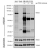 Immunoprecipitation analysis using Mouse Anti-VPS35 Monoclonal Antibody, Clone 11H10 (STMA00212). Tissue: embryonic fibroblast. Species: Mouse. Primary Antibody: Mouse Anti-VPS35 Monoclonal Antibody (STMA00212). Three amounts of STMA00212 (3, 1 and 0.3 ug) were non-covalently coupled to 10uL of A/G sepharose beads for 1 hour at 4°C and next incubated with 250ug of MEF lysate for 2 hours at 4°C.