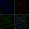 Immunocytochemistry/Immunofluorescence analysis using Mouse Anti-Tau Monoclonal Antibody, Clone 1D5 (STMA00213). Tissue: iPSC-derived neurons. Species: Human. Fixation: 4% PFA. Primary Antibody: Mouse Anti-Tau Monoclonal Antibody (STMA00213) at 1:100 for Overnight at 4°C. Counterstain: DAPI at 1:5000 for 5 minutes at RT in the dark. Magnification: 40X. Courtesy of: Francesco Paonessa.