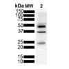 Western Blot analysis of Mouse Brain showing detection of Tau protein using Mouse Anti-Tau Monoclonal Antibody, Clone 3D4 (STMA00214). Lane 1: MW Marker. Lane 2: Mouse Brain (20ug). Block: 5% Skim Milk powder in TBST. Primary Antibody: Mouse Anti-Tau Monoclonal Antibody (STMA00214) at 1:1000 for 2 hours at RT with shaking. Secondary Antibody: Goat anti-mouse IgG:HRP at 1:5000 for 1 hour at RT with shaking.