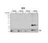 Western Blot analysis of Human HEK293 cells overexpressing RAB3A, RAB3B, RAB3C, and RAB3D showing detection of RAB3D protein using Mouse Anti-RAB3D Monoclonal Antibody, Clone 5E9 (STMA00219). Lane 1: MW ladder. Lanes 2-4: HEK293 cells overexpressing RAB3A. Lanes 5-7: HEK293 cells overexpressing RAB3B. Lanes 8-10: HEK293 cells overexpressing RAB3C. Lanes 11-13: HEK293 cells overexpressing RAB3D.