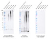 Immunohistochemistry (IHC) analysis on a temporal lobe section of a human Alzheimer’s diseased brain tissue. Block: 3% skim milk in PBST. Primary Antibody: Rabbit Anti-Amyloid Beta Oligomer Monoclonal Antibody, clone 1A2 (STMA00222) at 1:100. Secondary: Goat-anti-rabbit IgG:HRP at 1:100. Stained with DAB (1:50) and Hematoxylin (1:10).