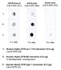 Dot blot analysis comparing STMA00225 with STPA00086 and STMA00193 showing differences in detection of Recombinant Human Alpha Synuclein aa 1-114 Monomer, Recombinant Human Alpha Synuclein-98 Monomer, and Recombinant Human Alpha Synuclein Full-length Monomer. Block: 5% skim milk for 1/2 hour at RT.