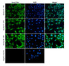 Immunocytochemistry/Immunofluorescence analysis with Rabbit Anti- Slo1 Monoclonal Antibody, Clone S22 (STMA00229). Tissue: Neuroblastoma cells (Kelly). Species: Human. Fixation: 4% PFA for 10 min at RT. Permeabilization: 0.15% TritonX for 15 min at RT. Blocking: 10% goat serum for 40 min at RT. Primary Antibody: Rabbit Anti-Mouse Slo1 Recombinant Monoclonal [S22] (STMA00229) at 1:100 for 1 hour at RT.