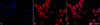 Immunocytochemistry/Immunofluorescence analysis using Rabbit Anti-Hsp40 Polyclonal Antibody (STPA00001). Tissue: Heat Shocked Cervical cancer cell line (HeLa). Species: Human. Fixation: 2% Formaldehyde for 20 min at RT. Primary Antibody: Rabbit Anti-Hsp40 Polyclonal Antibody (STPA00001) at 1:100 for 12 hours at 4°C. Secondary Antibody: APC Goat Anti-Rabbit (red) at 1:200 for 2 hours at RT.