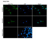 Immunocytochemistry/Immunofluorescence analysis with Rabbit Anti-Rat SAP97 Monoclonal Antibody, Clone G28 (STMA00235). Tissue: Neuroblastoma cells (Kelly). Species: Human. Fixation: 4% PFA for 10 min at RT. Permeabilization: 0.15% TritonX for 15 min at RT. Blocking: 10% goat serum for 40 min at RT. Primary Antibody: Rabbit Anti-Rat SAP97 Recombinant Monoclonal [G28] (STMA00235) at 1:100 for 1 hour at RT.